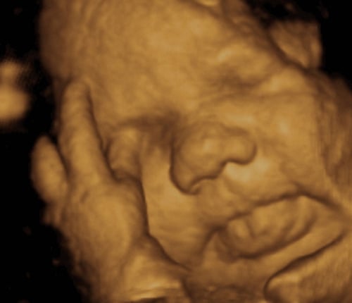 Imagini pentru second trimester ultrasound done