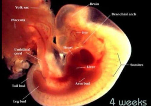 Four-week-old embryo has the same size as a seed.