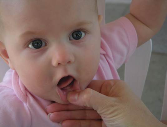 Description: Teething is an important milestone in the development of your baby