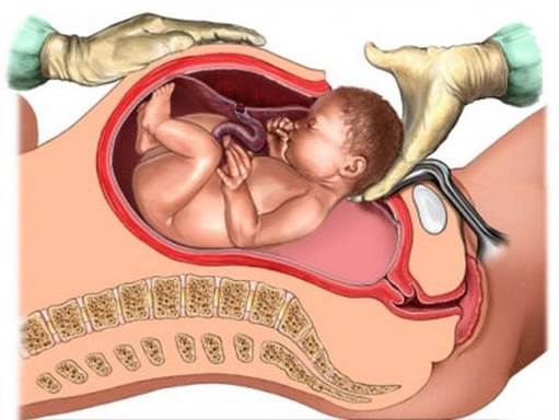 Fetus can be affected by anesthetic, have injury in surgery.