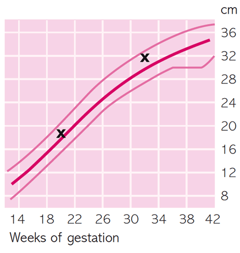 Abdominal Girth Chart In Pregnancy