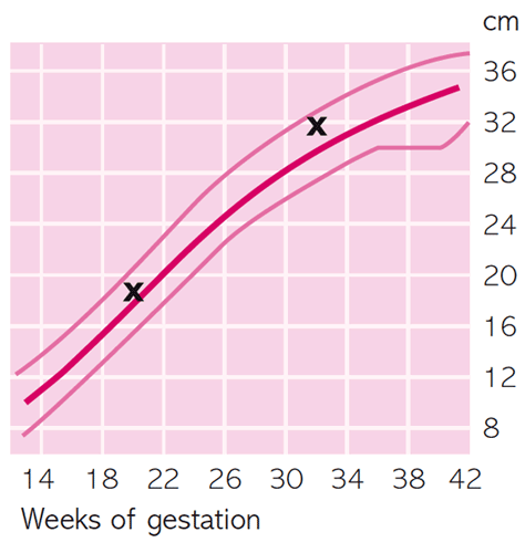 Weeks And Trimesters Chart