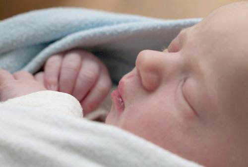 Newborn babies are choked and it means that they cannot breathe normally.