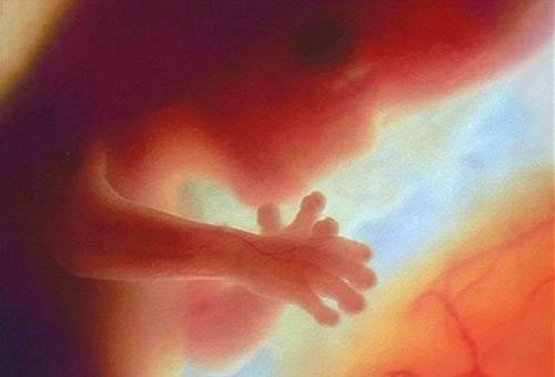 In those weeks of pregnancy, women can hear fetal heartbeat clearly.