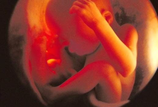 When fetuses are 28 weeks old, they are about 1.3 kg.