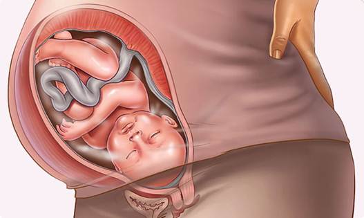 Description: normal fetus at 40th week of pregnancy