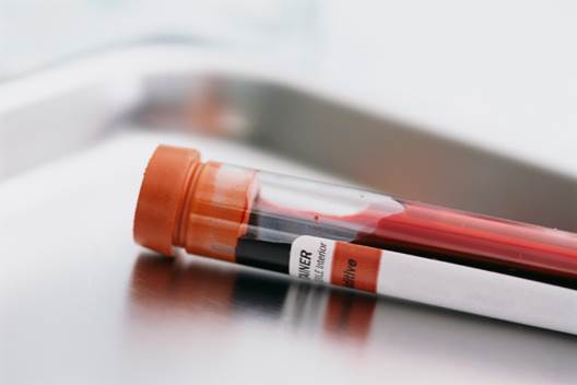 There’s only blood test that can detect diabetes.
