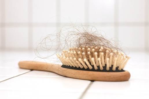 There’re over 90% of women having hair loss after pregnancy.