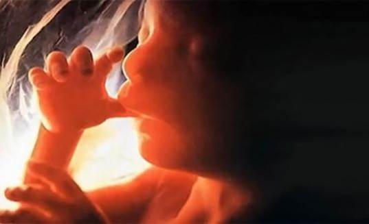 Your fetuses have fingertips at the 13th week and have leavens of 32 teeth in both jaws at the 14th week of pregnancy.