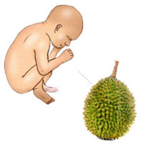 33-week fetus has size equaling to a durian.