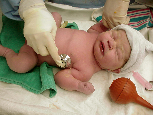 Newborn babies sneeze a lot, but do not because they are cold or ill. 