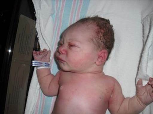 Strange discoveries on newborn babies
