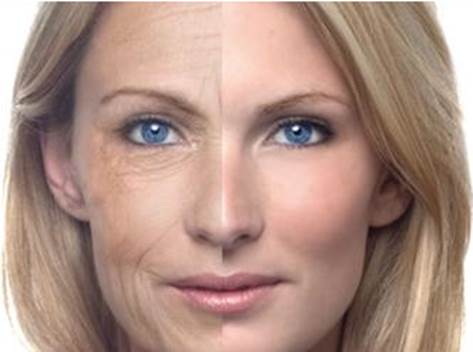 Description: Botox is injected directly into the skin
